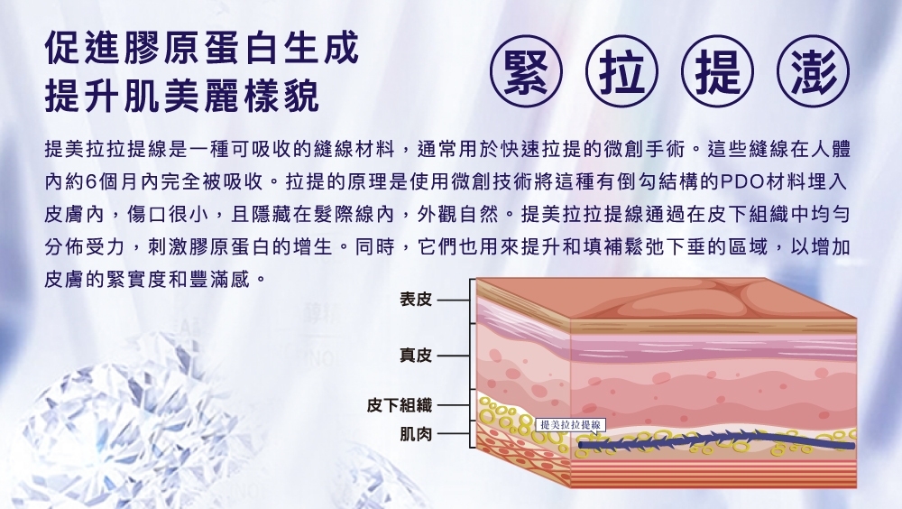 晶鑽診所 埋線拉提 拉皮 醫美推薦 整形外科