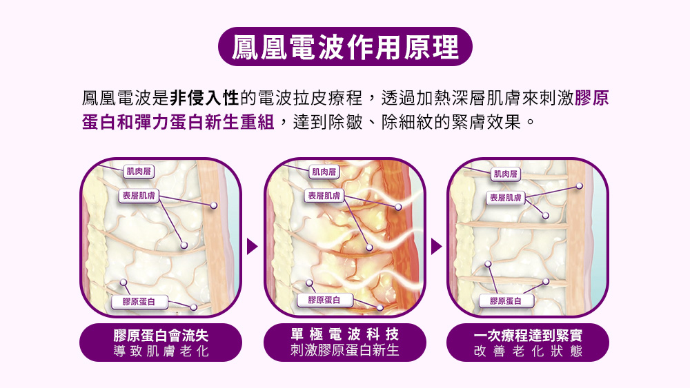 晶鑽診所 鳳凰電波原廠認證 醫美推薦 電波拉提