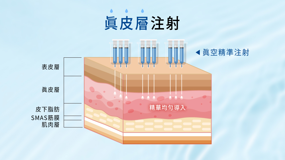 晶鑽診所 水光槍 水光針 臉部保濕 水光注射 肌膚深層潤澤