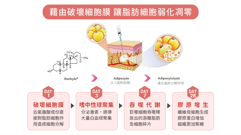 晶鑽診所 Ronkyla容脂針 消脂針 減脂瘦身 健康減脂