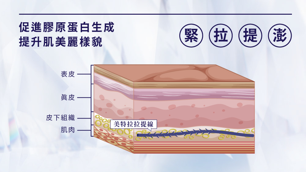 晶鑽診所 埋線拉提 緊緻拉提 埋線拉皮推薦 埋線拉提專家