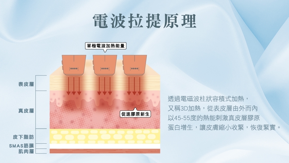 晶鑽診所 拉提醫美 音波 電波 埋線 醫美推薦