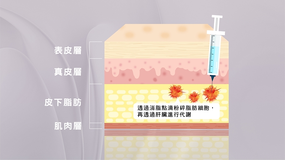 晶鑽診所 消脂點滴 窈窕點滴 健康瘦身