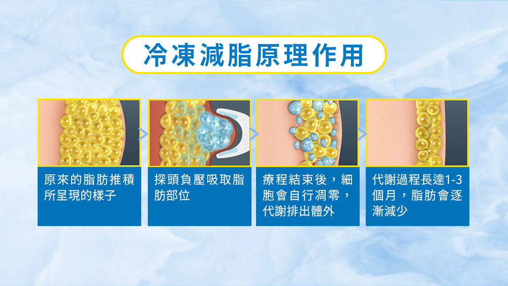 晶鑽診所_酷塑冷凍減脂原理