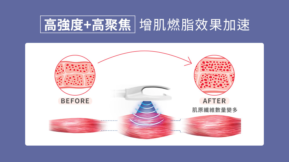 增肌減脂 晶鑽診所 CMSlim先舒立的原理