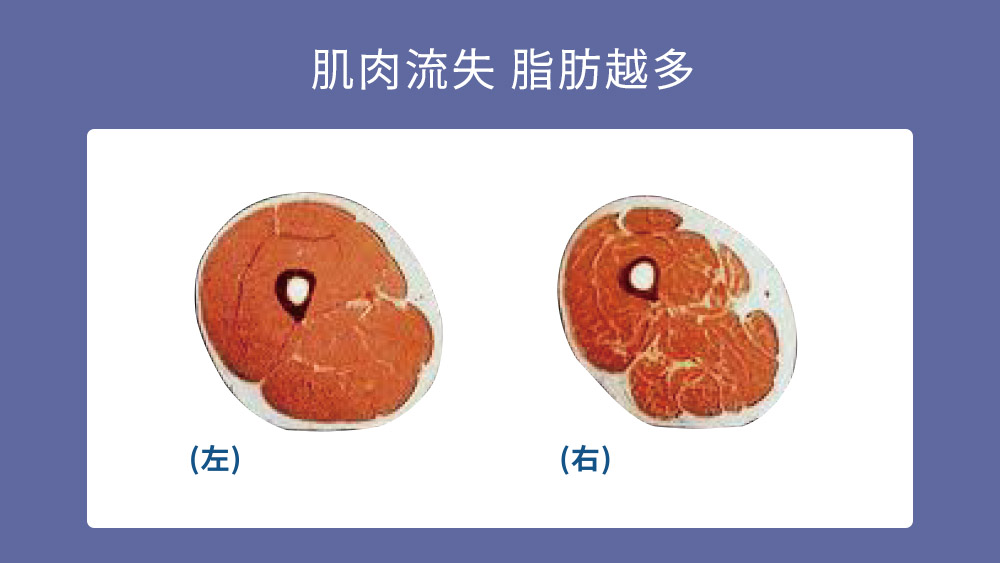 EMBODY增肌減脂​ 肌肉流失 晶鑽診所