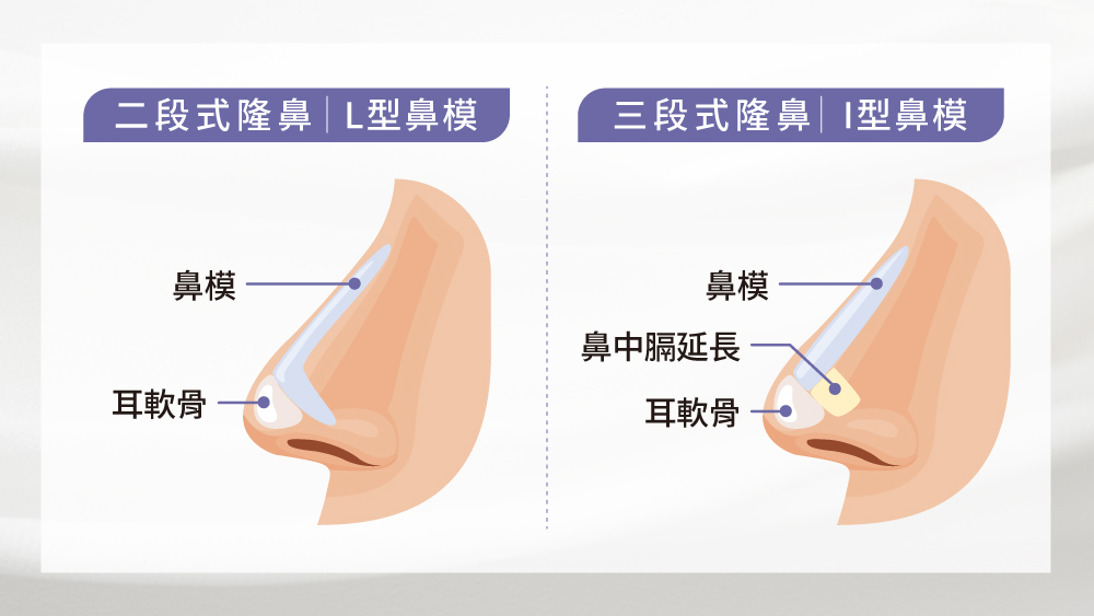 晶鑽診所-Gore-Tex卡麥拉隆鼻 三段式隆鼻