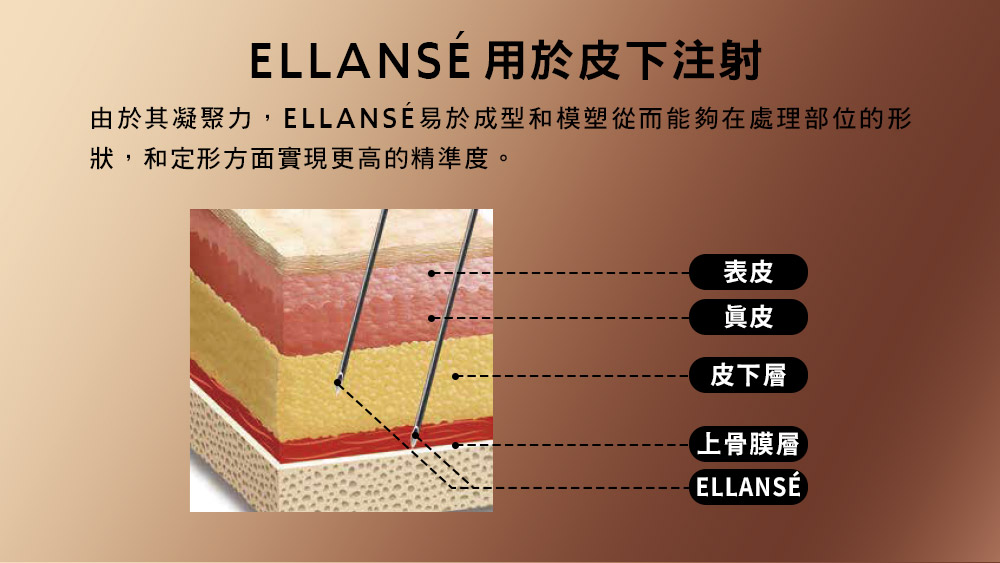 晶鑽診所_洢蓮絲推薦 膠原蛋白增生劑注射推薦