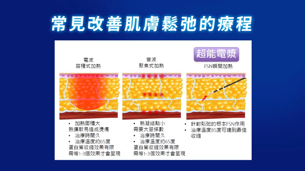 晶鑽診所 超能電漿是什麼? 超能電漿 介紹3常見改善療程